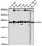 Dynactin Subunit 1 antibody, GTX54021, GeneTex, Western Blot image 
