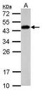 Scm Polycomb Group Protein Like 4 antibody, GTX122421, GeneTex, Western Blot image 