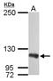 Double-stranded RNA-specific adenosine deaminase antibody, TA308833, Origene, Western Blot image 