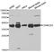 Casein Kinase 2 Alpha 1 antibody, TA327103, Origene, Western Blot image 