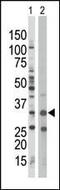 Protein Kinase AMP-Activated Non-Catalytic Subunit Beta 1 antibody, MBS9209819, MyBioSource, Western Blot image 