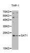 Spermidine/Spermine N1-Acetyltransferase 1 antibody, abx001949, Abbexa, Western Blot image 