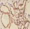 Stomatin Like 1 antibody, FNab08345, FineTest, Immunohistochemistry paraffin image 