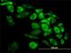 Capping Actin Protein, Gelsolin Like antibody, H00000822-M02, Novus Biologicals, Immunofluorescence image 