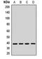 ARSA antibody, LS-C668160, Lifespan Biosciences, Western Blot image 