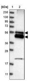 BCL2 Interacting Protein 2 antibody, NBP1-88559, Novus Biologicals, Western Blot image 