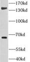 GRAM Domain Containing 4 antibody, FNab03629, FineTest, Western Blot image 