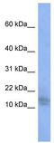 Bromodomain And WD Repeat Domain Containing 1 antibody, TA344091, Origene, Western Blot image 