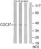 Hsp90 co-chaperone Cdc37 antibody, TA312777, Origene, Western Blot image 