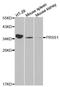 Serine Protease 1 antibody, orb49145, Biorbyt, Western Blot image 