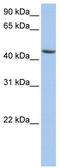 Aldehyde Dehydrogenase 3 Family Member B1 antibody, TA336222, Origene, Western Blot image 
