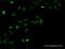 Zinc Finger And SCAN Domain Containing 18 antibody, H00065982-M04, Novus Biologicals, Western Blot image 