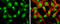 Nei Like DNA Glycosylase 2 antibody, GTX132565, GeneTex, Immunofluorescence image 