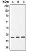 CD9 Molecule antibody, MBS821978, MyBioSource, Western Blot image 