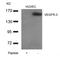 Fms Related Tyrosine Kinase 4 antibody, TA347855, Origene, Western Blot image 