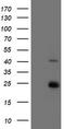 Ubiquitin Conjugating Enzyme E2 E3 antibody, TA800071S, Origene, Western Blot image 