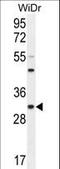 RILP-like protein 2 antibody, LS-C162606, Lifespan Biosciences, Western Blot image 