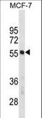Polypyrimidine Tract Binding Protein 1 antibody, LS-C155877, Lifespan Biosciences, Western Blot image 