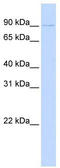 PR/SET Domain 13 antibody, TA345336, Origene, Western Blot image 