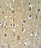Neuronal acetylcholine receptor subunit alpha-3 antibody, LS-C168754, Lifespan Biosciences, Immunohistochemistry paraffin image 