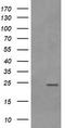 RAB21, Member RAS Oncogene Family antibody, TA505747BM, Origene, Western Blot image 