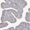 Zinc Finger CCCH-Type Containing 6 antibody, NBP1-81909, Novus Biologicals, Immunohistochemistry frozen image 