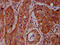BICD Cargo Adaptor 2 antibody, CSB-PA844723LA01HU, Cusabio, Immunohistochemistry frozen image 