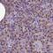 Cancer Susceptibility 4 antibody, NBP2-30492, Novus Biologicals, Immunohistochemistry paraffin image 