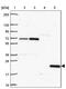 SPRY Domain Containing 4 antibody, PA5-62794, Invitrogen Antibodies, Western Blot image 