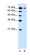 Solute Carrier Family 5 Member 4 antibody, orb325110, Biorbyt, Western Blot image 