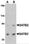 SATB Homeobox 2 antibody, 4629, ProSci, Western Blot image 