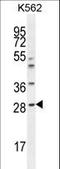 Amyloid P Component, Serum antibody, LS-C156399, Lifespan Biosciences, Western Blot image 