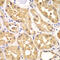 Protein Kinase AMP-Activated Non-Catalytic Subunit Gamma 3 antibody, abx007144, Abbexa, Western Blot image 