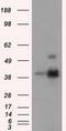 ERCC Excision Repair 1, Endonuclease Non-Catalytic Subunit antibody, GTX84546, GeneTex, Western Blot image 