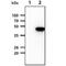 Serpin Family A Member 12 antibody, NBP1-04354, Novus Biologicals, Western Blot image 