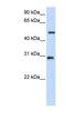 Zinc Finger Protein 138 antibody, NBP1-79235, Novus Biologicals, Western Blot image 