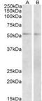 Vasoactive intestinal polypeptide receptor 1 antibody, MBS422625, MyBioSource, Western Blot image 