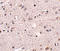 Melanocortin 4 Receptor antibody, A00619, Boster Biological Technology, Immunohistochemistry paraffin image 