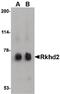 RNA-binding protein MEX3C antibody, PA5-20622, Invitrogen Antibodies, Western Blot image 