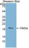 ADAM Metallopeptidase With Thrombospondin Type 1 Motif 5 antibody, LS-C315012, Lifespan Biosciences, Western Blot image 