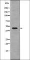 EPH Receptor A8 antibody, orb335811, Biorbyt, Western Blot image 