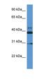Vasodilator Stimulated Phosphoprotein antibody, orb331127, Biorbyt, Western Blot image 