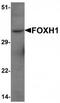 Forkhead Box H1 antibody, TA319763, Origene, Western Blot image 