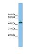 Nodal Growth Differentiation Factor antibody, orb330915, Biorbyt, Western Blot image 
