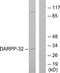 Protein Phosphatase 1 Regulatory Inhibitor Subunit 1B antibody, TA312428, Origene, Western Blot image 