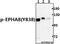 EPH Receptor A8 antibody, A06731Y838, Boster Biological Technology, Western Blot image 