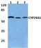 Cytochrome P450 Family 24 Subfamily A Member 1 antibody, LS-B12652, Lifespan Biosciences, Western Blot image 