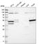 Serine/Threonine Kinase 17a antibody, HPA018138, Atlas Antibodies, Western Blot image 