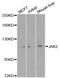 Janus Kinase 2 antibody, A7694, ABclonal Technology, Western Blot image 