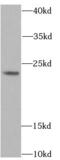 Acid Phosphatase antibody, FNab00098, FineTest, Western Blot image 